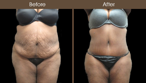 20202705151852_B14-Front